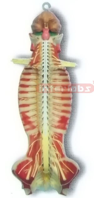 HITCH-HANGING, HUMAN SPINAL CORD MODEL IN SPINAL CANAL